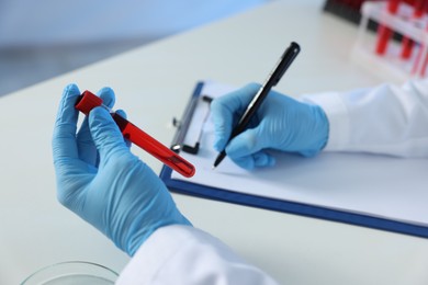 Photo of Laboratory testing. Doctor with blood sample taking notes at table indoors, closeup