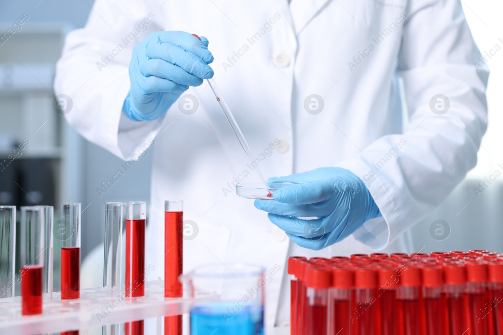 Photo of Laboratory testing. Doctor dripping blood sample into Petri dish indoors, closeup