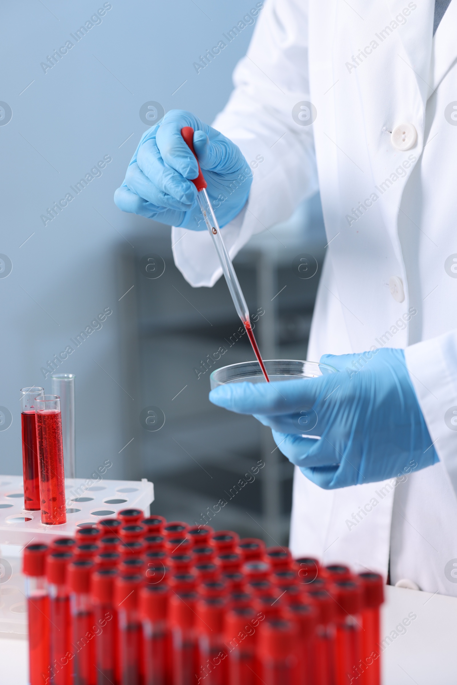 Photo of Laboratory testing. Doctor dripping blood sample into Petri dish indoors, closeup