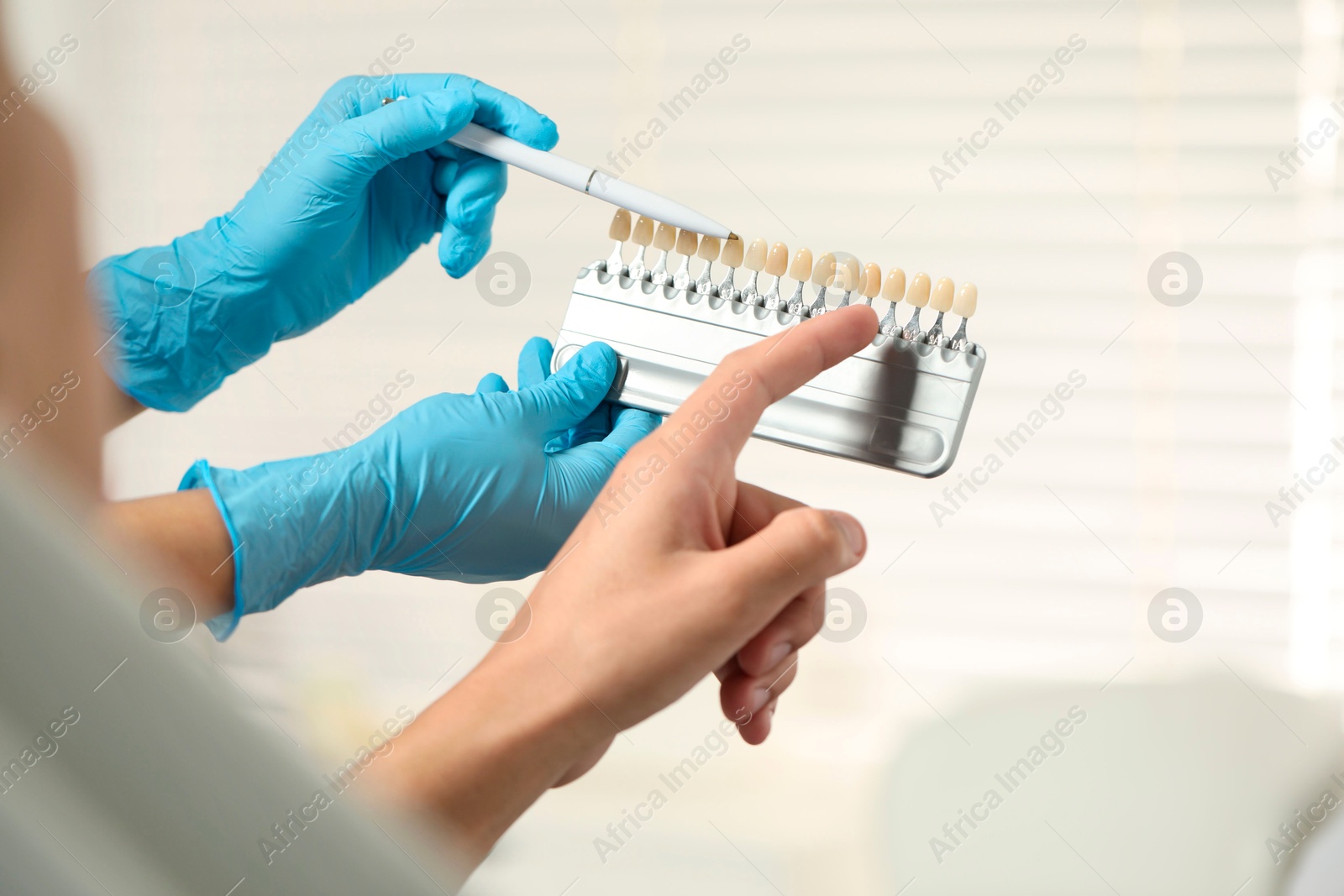 Photo of Doctor and patient choosing shade on teeth color palette in clinic, closeup. Dental veneers