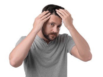 Man with hair loss problem on white background