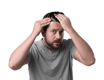 Man with hair loss problem on white background