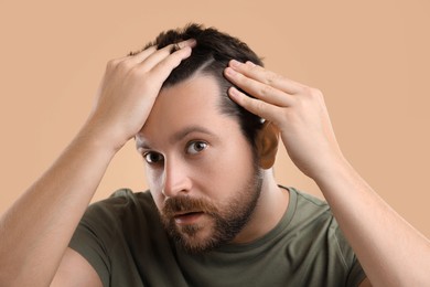 Man with hair loss problem on beige background