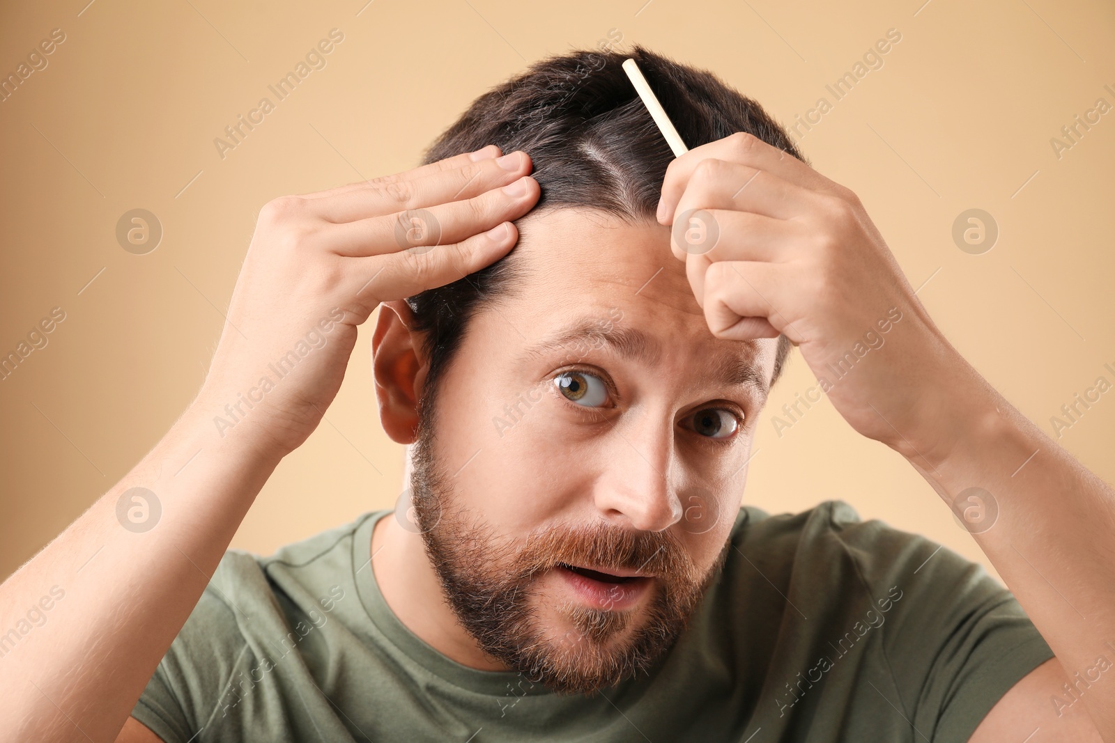 Photo of Man brushing his hair on beige background. Alopecia problem