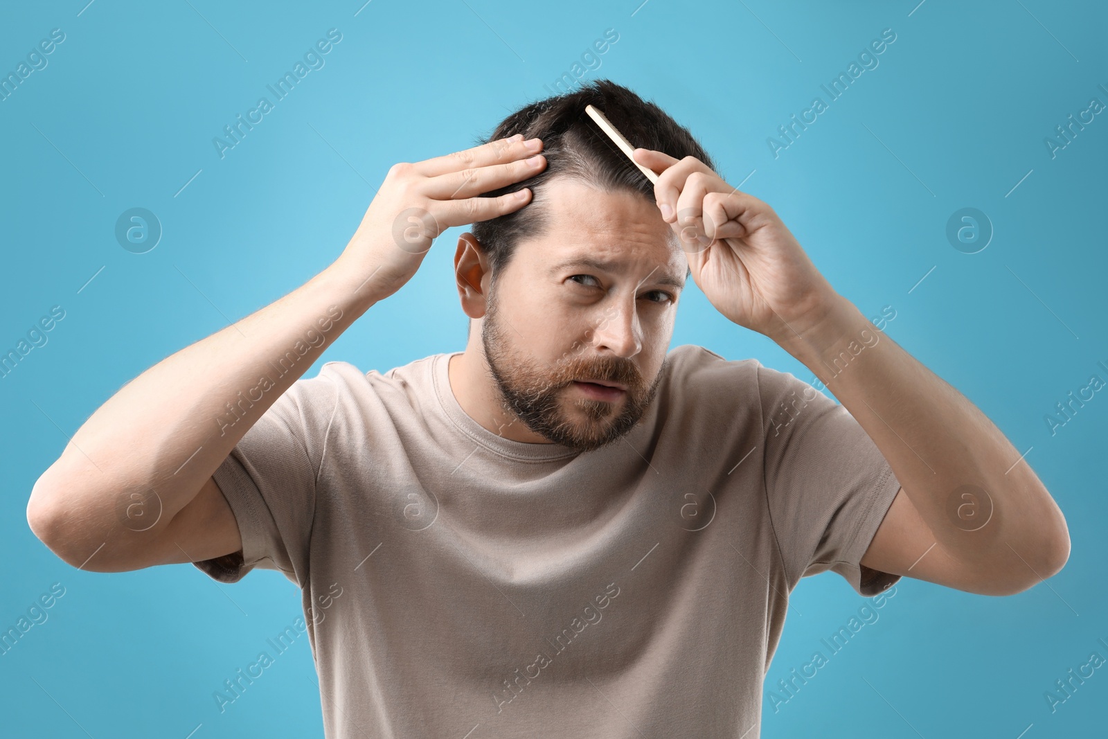 Photo of Man brushing his hair on light blue background. Alopecia problem