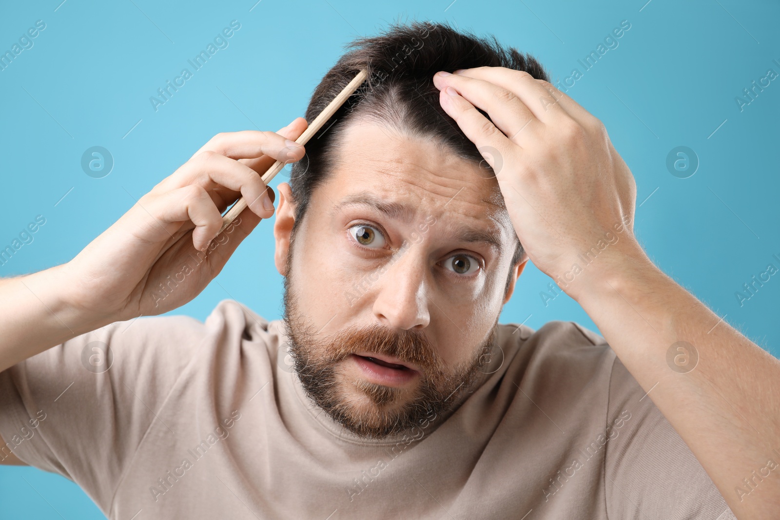 Photo of Man brushing his hair on light blue background. Alopecia problem