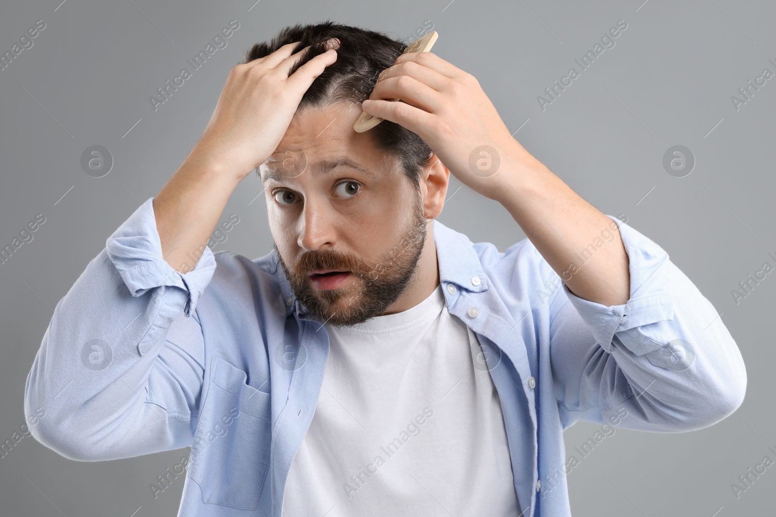 Photo of Man brushing his hair on gray background. Alopecia problem