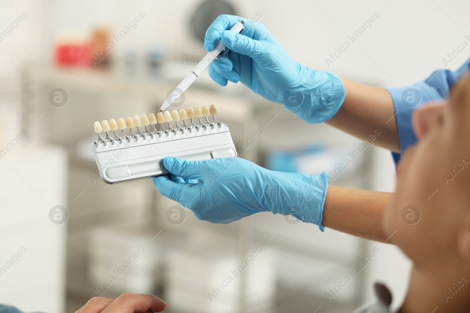 Photo of Doctor and patient choosing shade on teeth color palette in clinic, closeup. Dental veneers