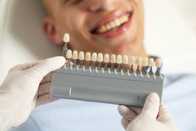 Photo of Doctor checking young man's teeth color in clinic, closeup. Dental veneers