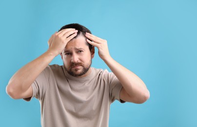 Man with hair loss problem on light blue background, space for text