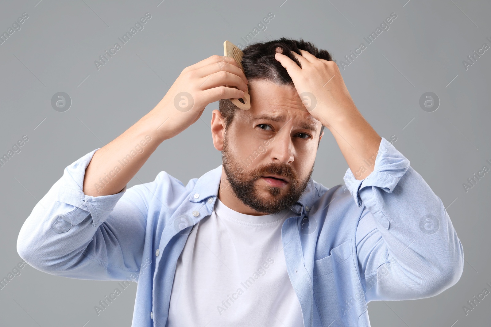 Photo of Man brushing his hair on gray background. Alopecia problem