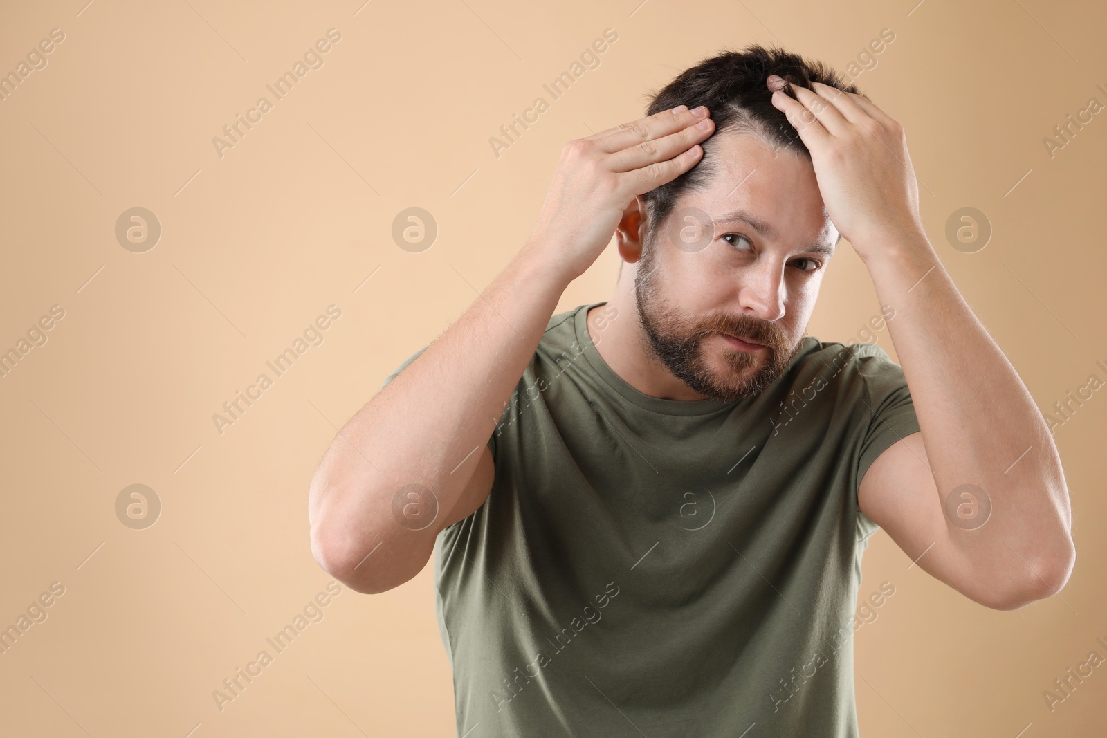 Photo of Man with hair loss problem on beige background, space for text