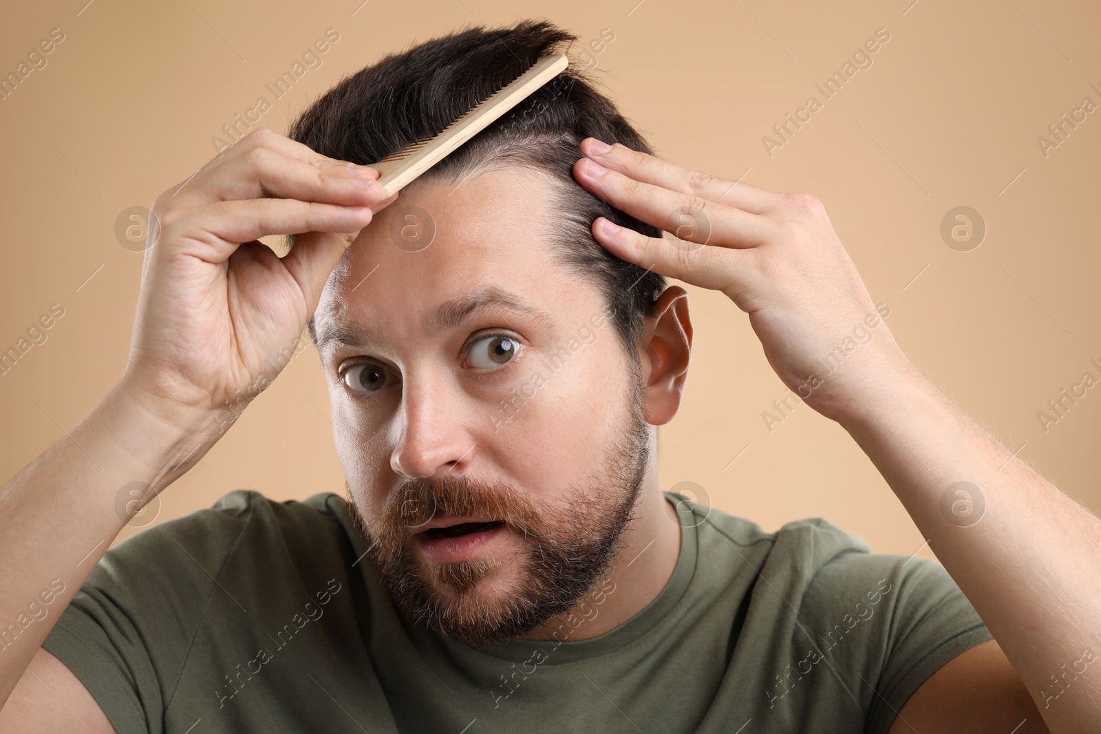 Photo of Man brushing his hair on beige background. Alopecia problem