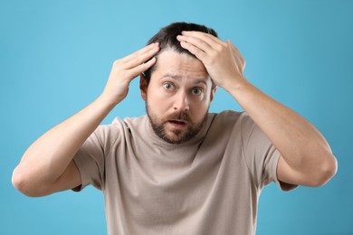 Photo of Man with hair loss problem on light blue background