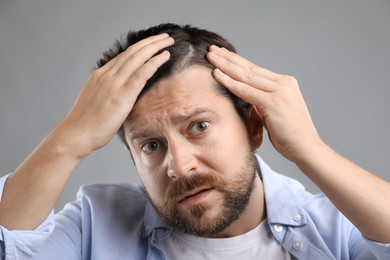 Photo of Man with hair loss problem on gray background