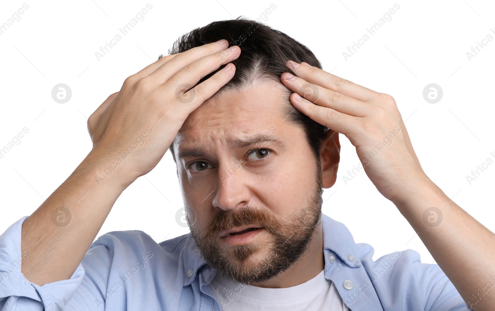 Photo of Man with hair loss problem on white background