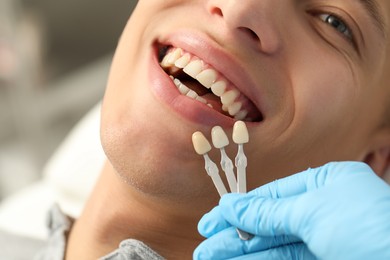 Doctor checking young man's teeth color in clinic, closeup. Dental veneers