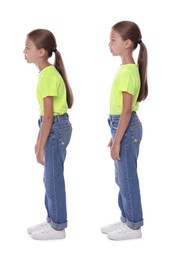 Image of Good and bad posture, collage. Girl standing on white background, side view