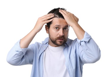 Man with hair loss problem on white background