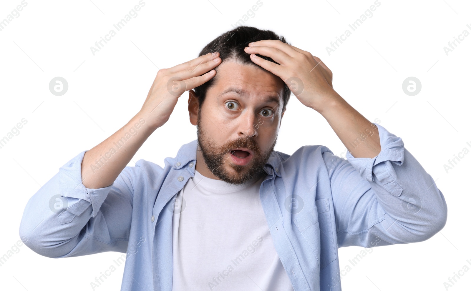 Photo of Man with hair loss problem on white background