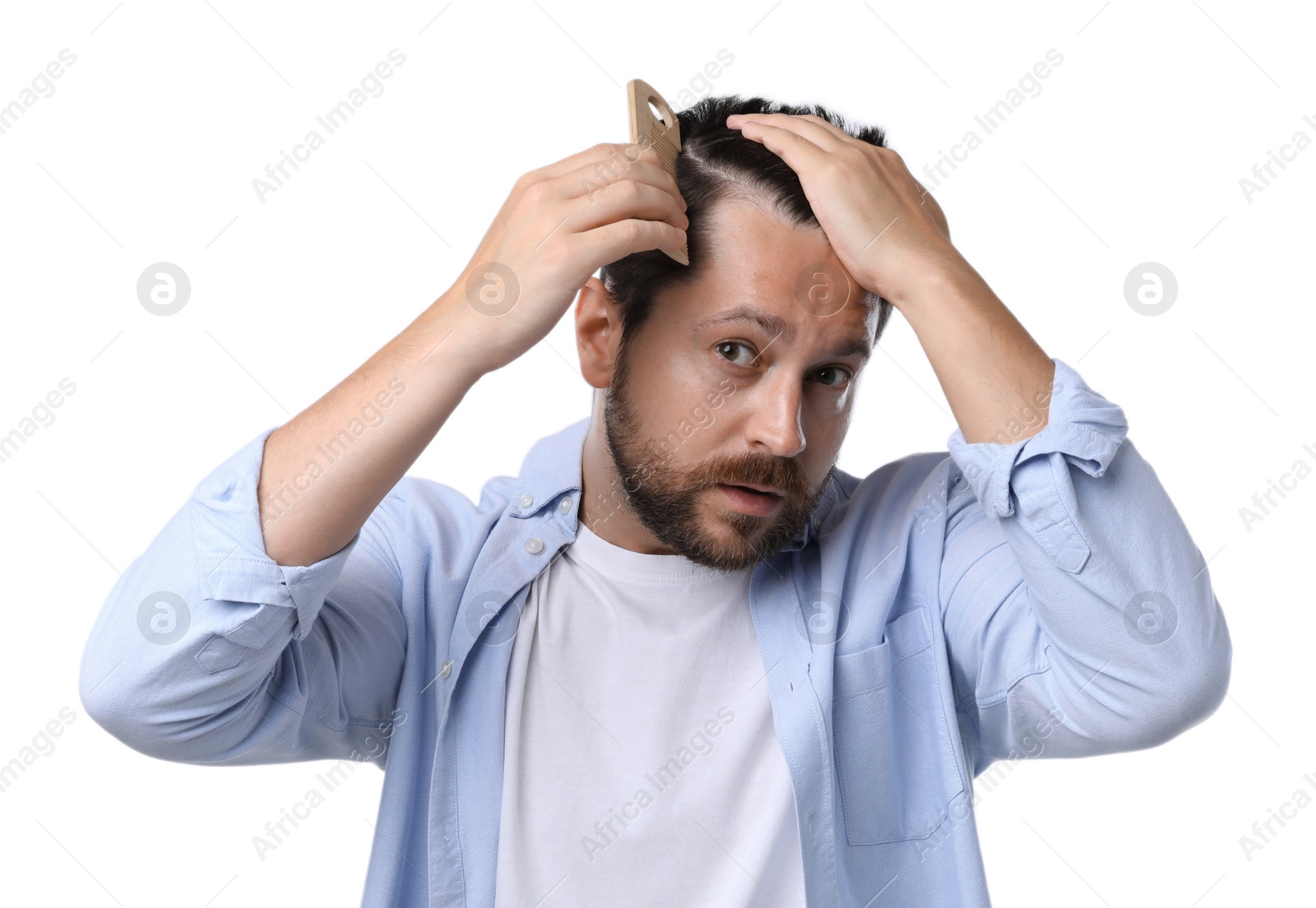 Photo of Man brushing his hair on white background. Alopecia problem