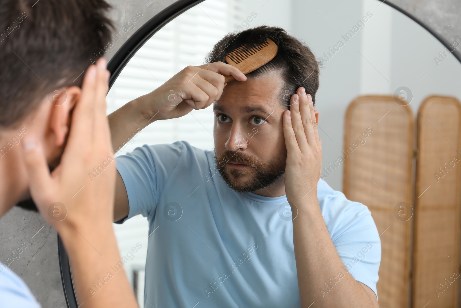 Photo of Man brushing his hair near mirror indoors. Alopecia problem