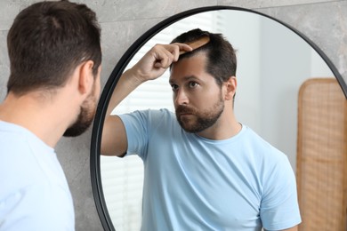 Photo of Man brushing his hair near mirror indoors. Alopecia problem