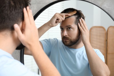 Photo of Man brushing his hair near mirror indoors. Alopecia problem