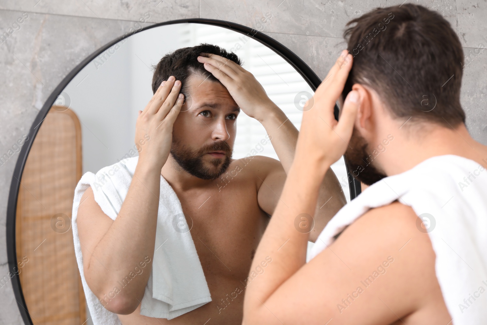 Photo of Man with hair loss problem looking at mirror indoors