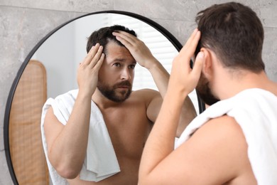 Photo of Man with hair loss problem looking at mirror indoors