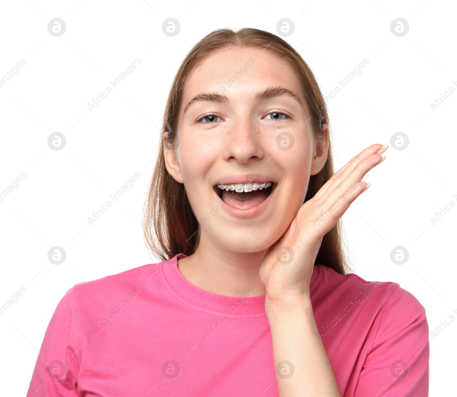 Photo of Smiling girl with braces on white background