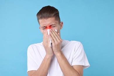 Young man with tissue suffering from sinusitis on light blue background