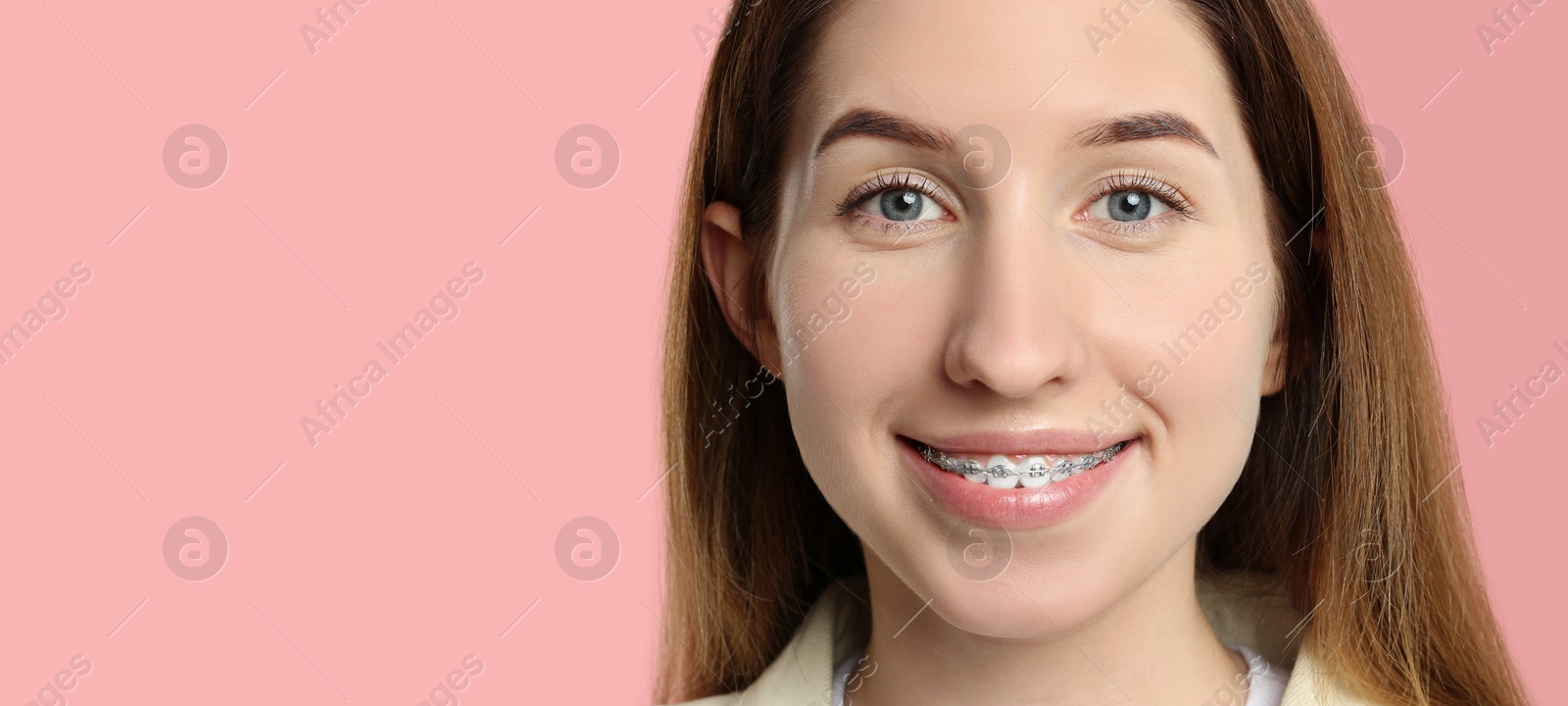 Image of Beautiful woman with braces smiling on pink background. Banner design with space for text