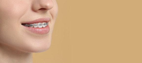 Woman with braces smiling on dark beige background, closeup. Banner design with space for text