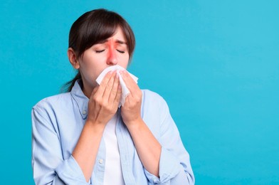 Image of Woman with tissue suffering from sinusitis on light blue background. Space for text