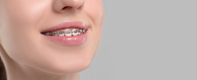 Woman with braces smiling on light background, closeup. Banner design with space for text