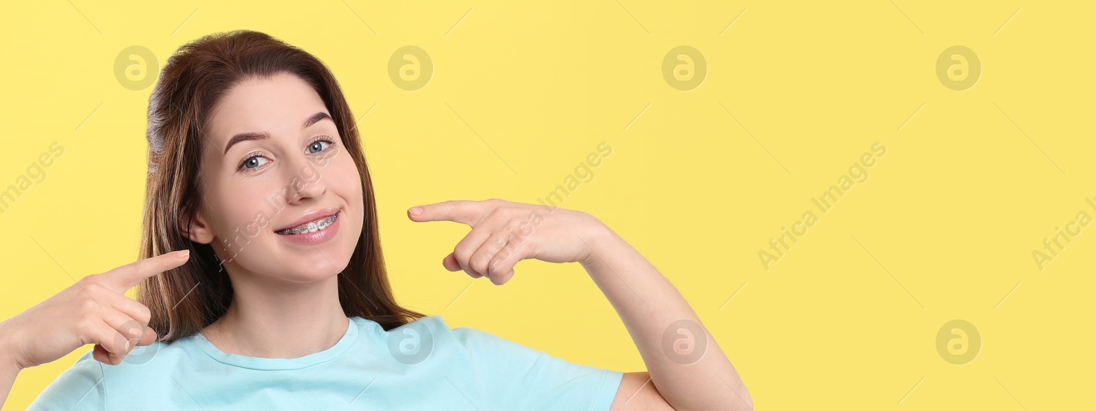 Image of Beautiful woman with braces pointing at her mouth on yellow background. Banner design with space for text