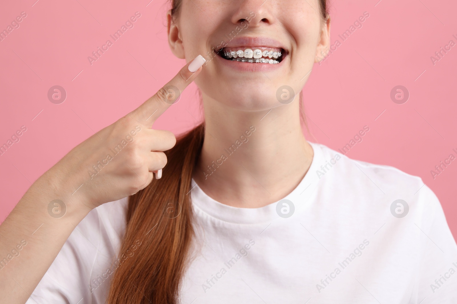 Photo of Girl pointing at her braces on pink background, closeup