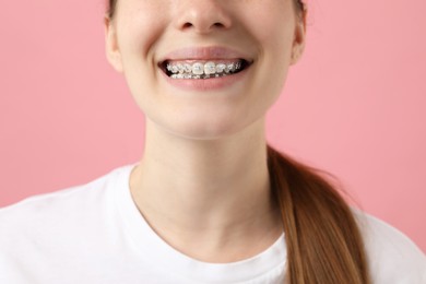 Photo of Girl with braces on pink background, closeup