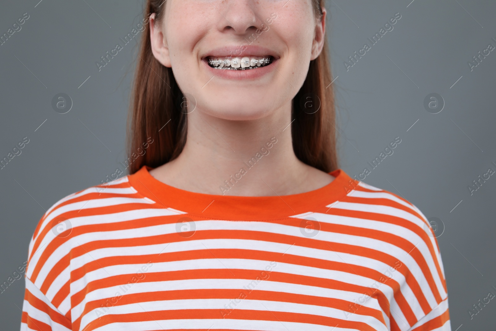 Photo of Girl with braces on grey background, closeup