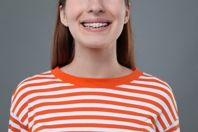 Photo of Girl with braces on grey background, closeup