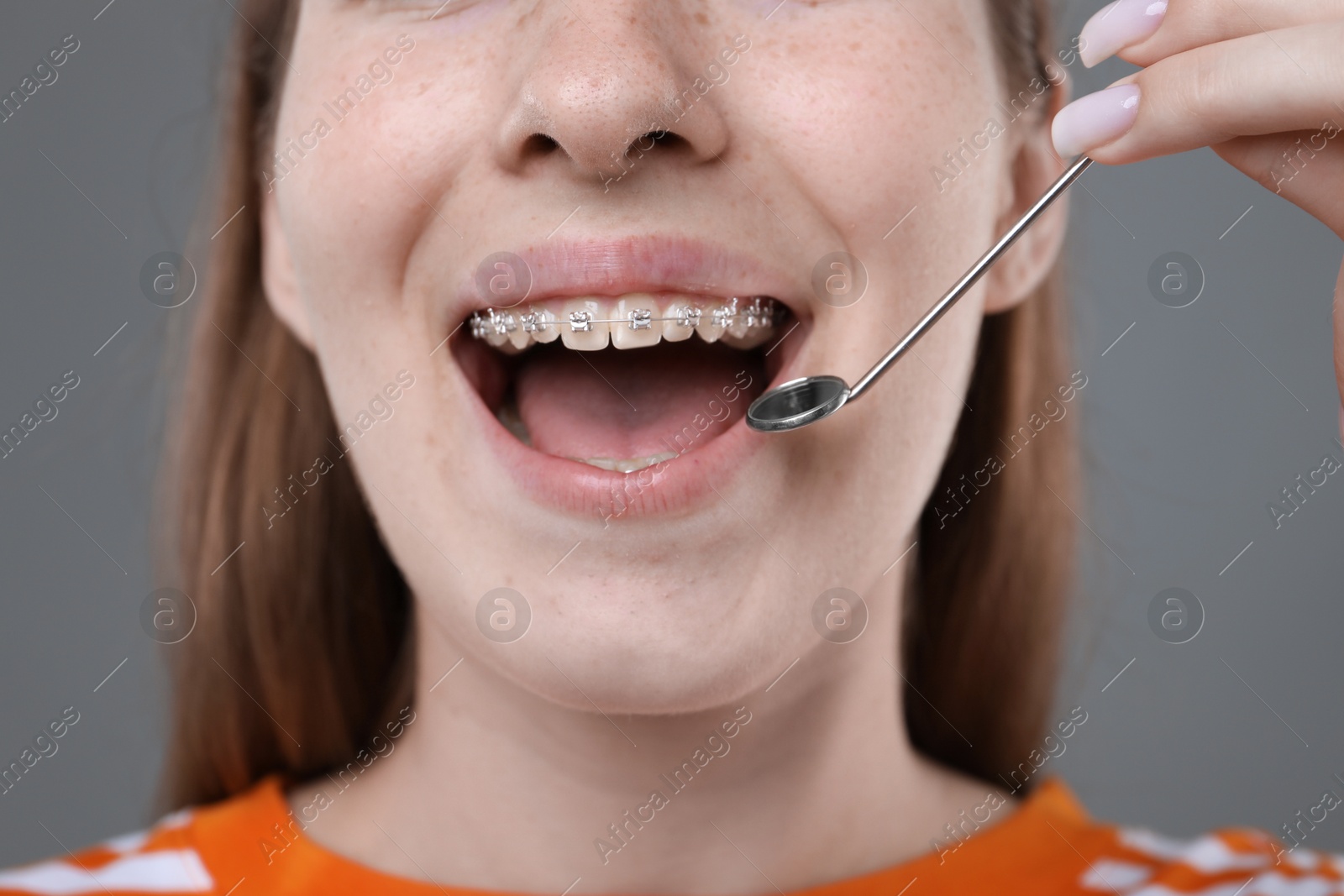 Photo of Girl with braces using dental mirror on grey background, closeup