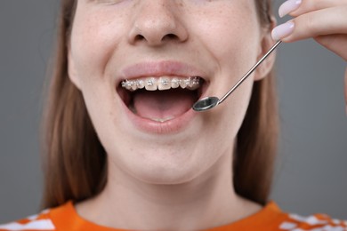 Photo of Girl with braces using dental mirror on grey background, closeup