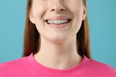 Photo of Girl with braces on light blue background, closeup