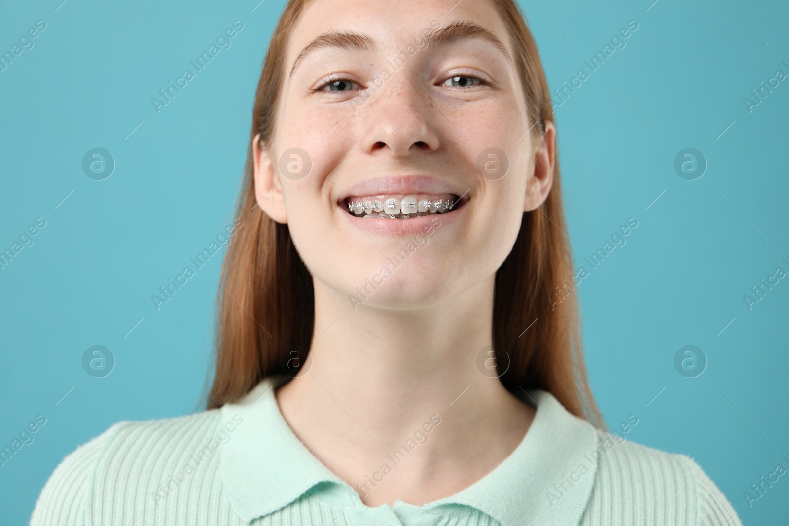 Photo of Smiling girl with braces on light blue background