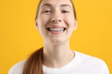 Photo of Smiling girl with braces on orange background