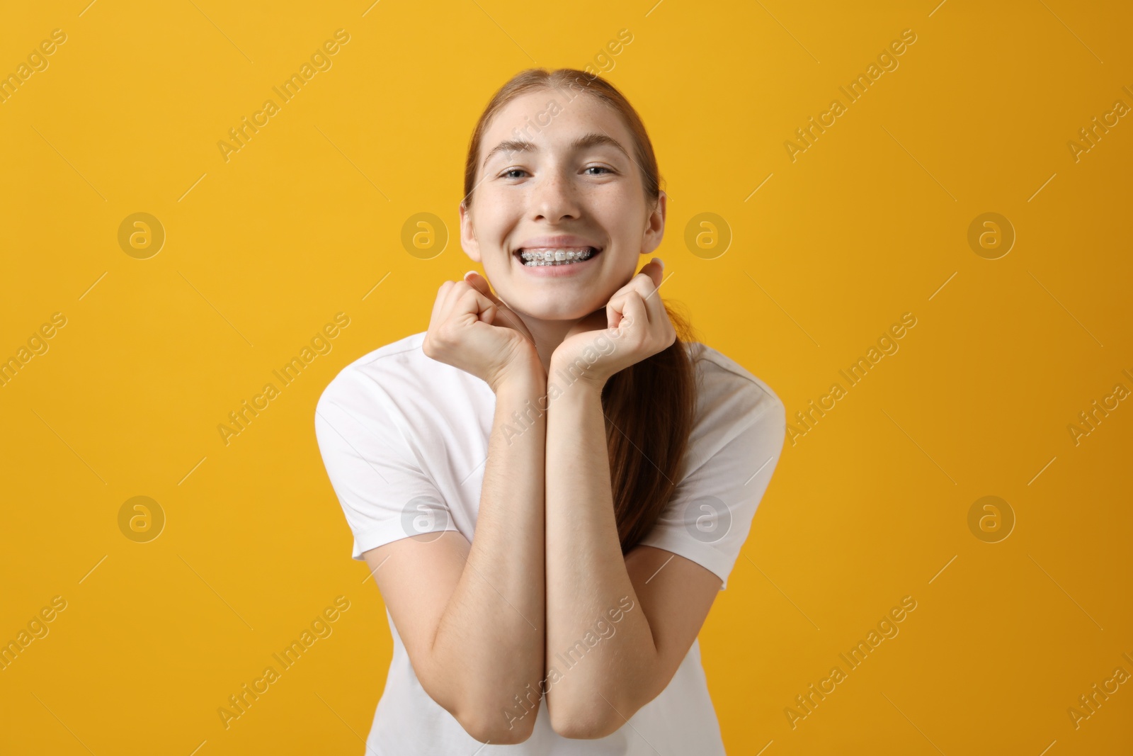 Photo of Smiling girl with braces on orange background