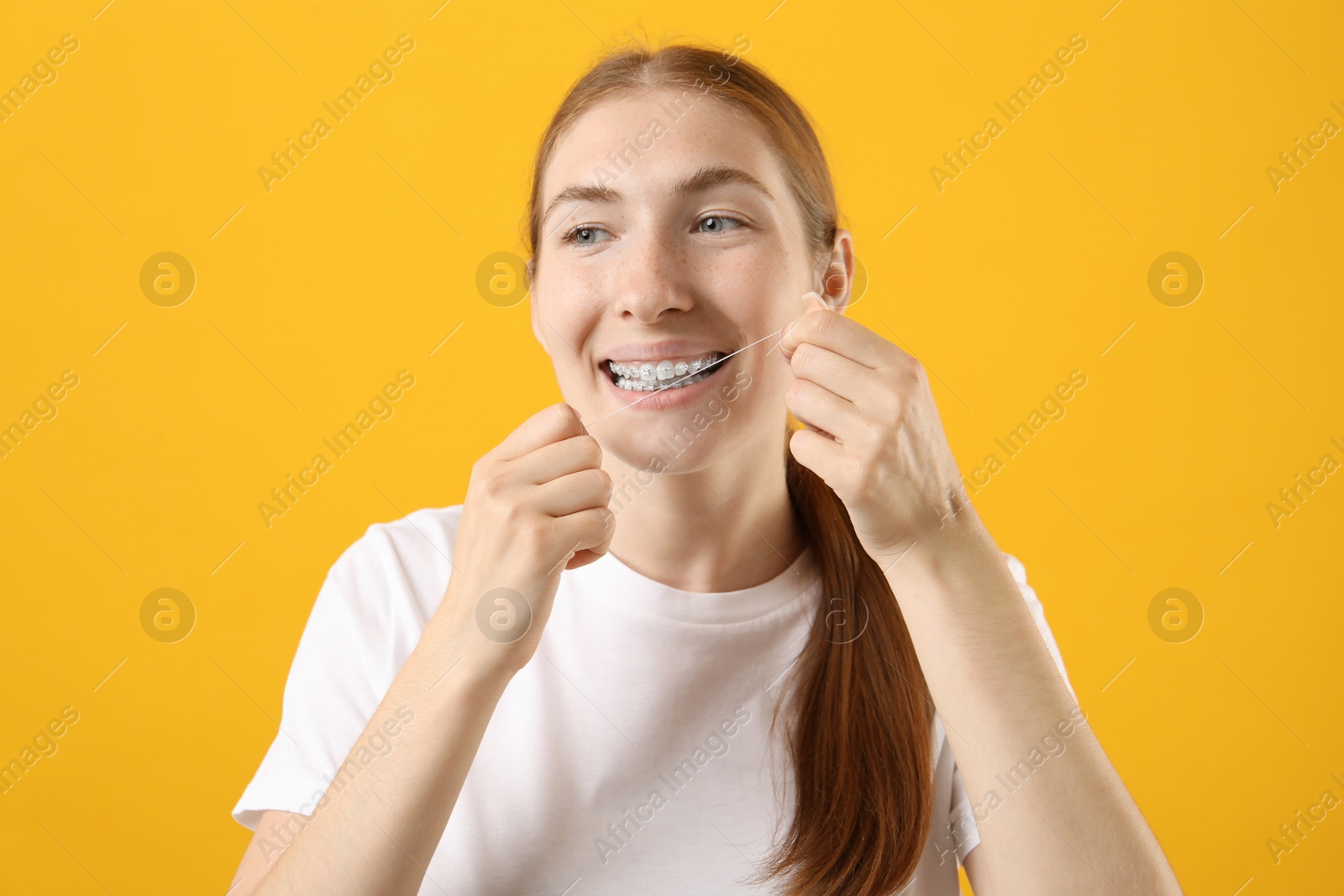 Photo of Girl with braces cleaning teeth with dental floss on orange background