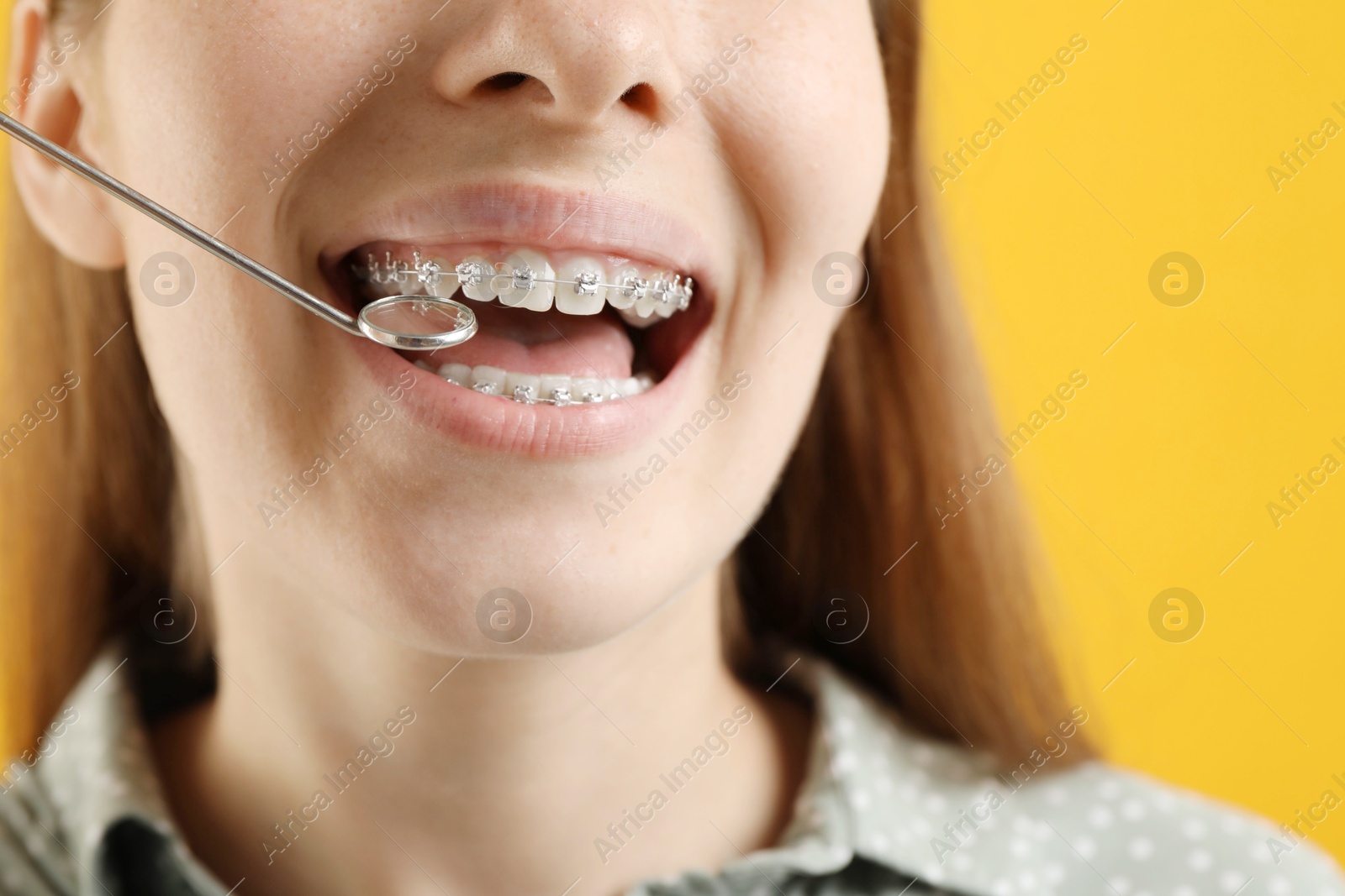 Photo of Girl with braces using dental mirror on orange background, closeup