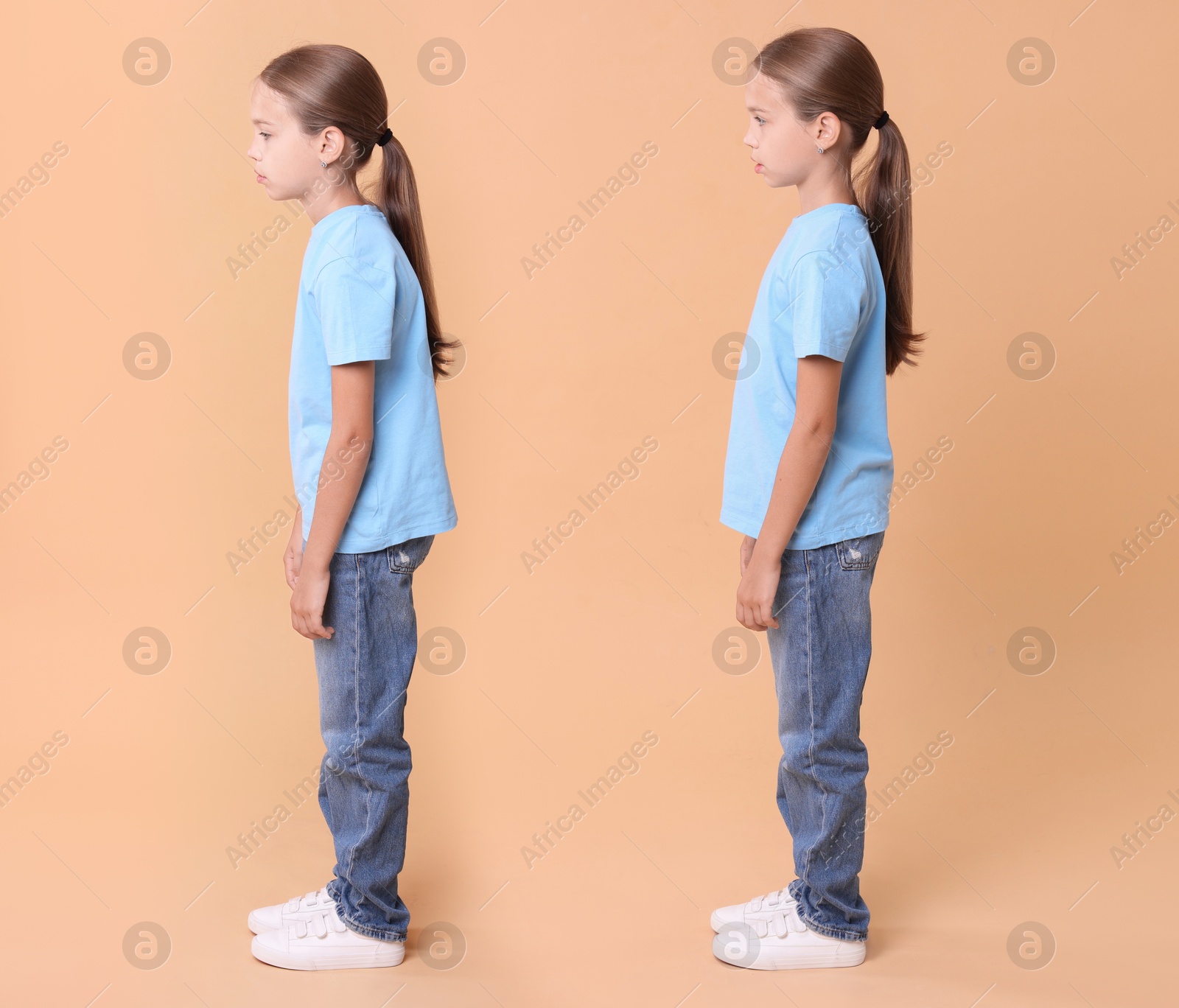 Image of Good and bad posture, collage. Girl standing on dark beige background, side view